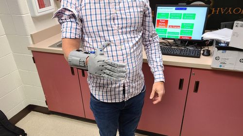 This team of high schoolers is building accessibility with free, 3D-printed prosthetics - Vimarsana News