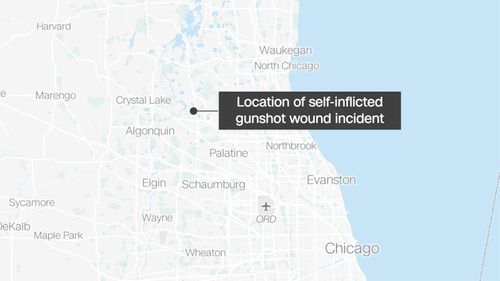 An Illinois man fired his gun after dreaming a burglar was in his home, police say. He ended up shooting himself in real life - Vimarsana News