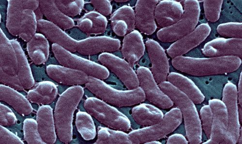 3 People have died after infection with rare flesh-eating bacteria in Connecticut and New York - Vimarsana News