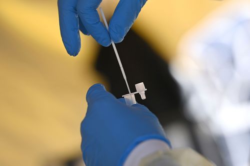 Early lab tests suggest new Covid-19 variant BA.2.86 may be less contagious and less immune-evasive than feared - Vimarsana News