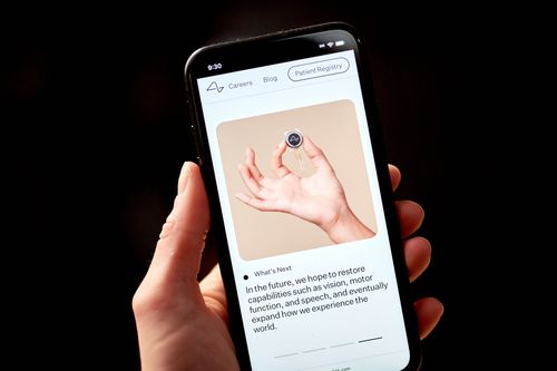 First Neuralink human trial subject can control a computer mouse with brain implant, Elon Musk says - Vimarsana News