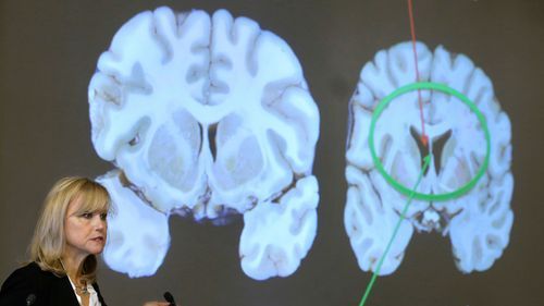 Steven Senne/AP via CNN Newsource